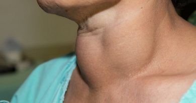 Lipoma in the neck